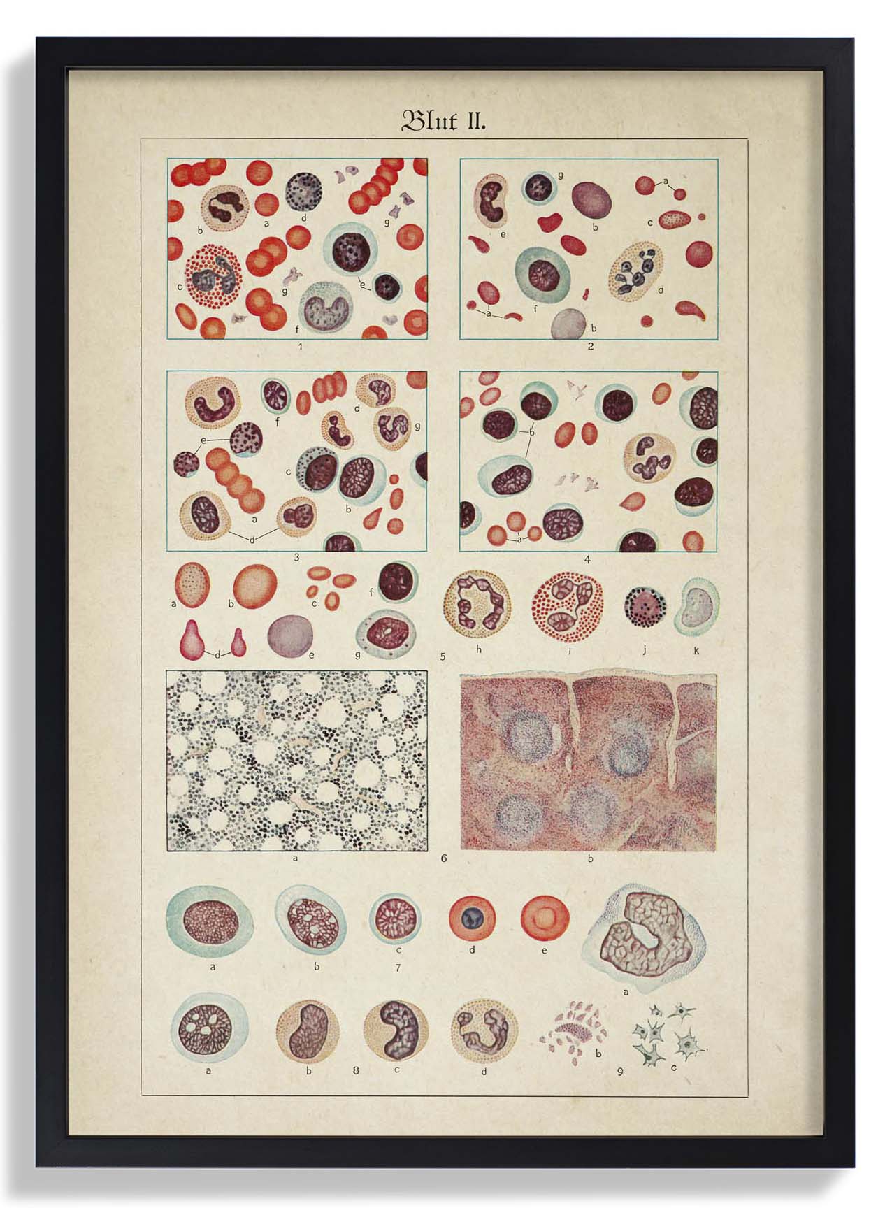 Antique Blood Cells
