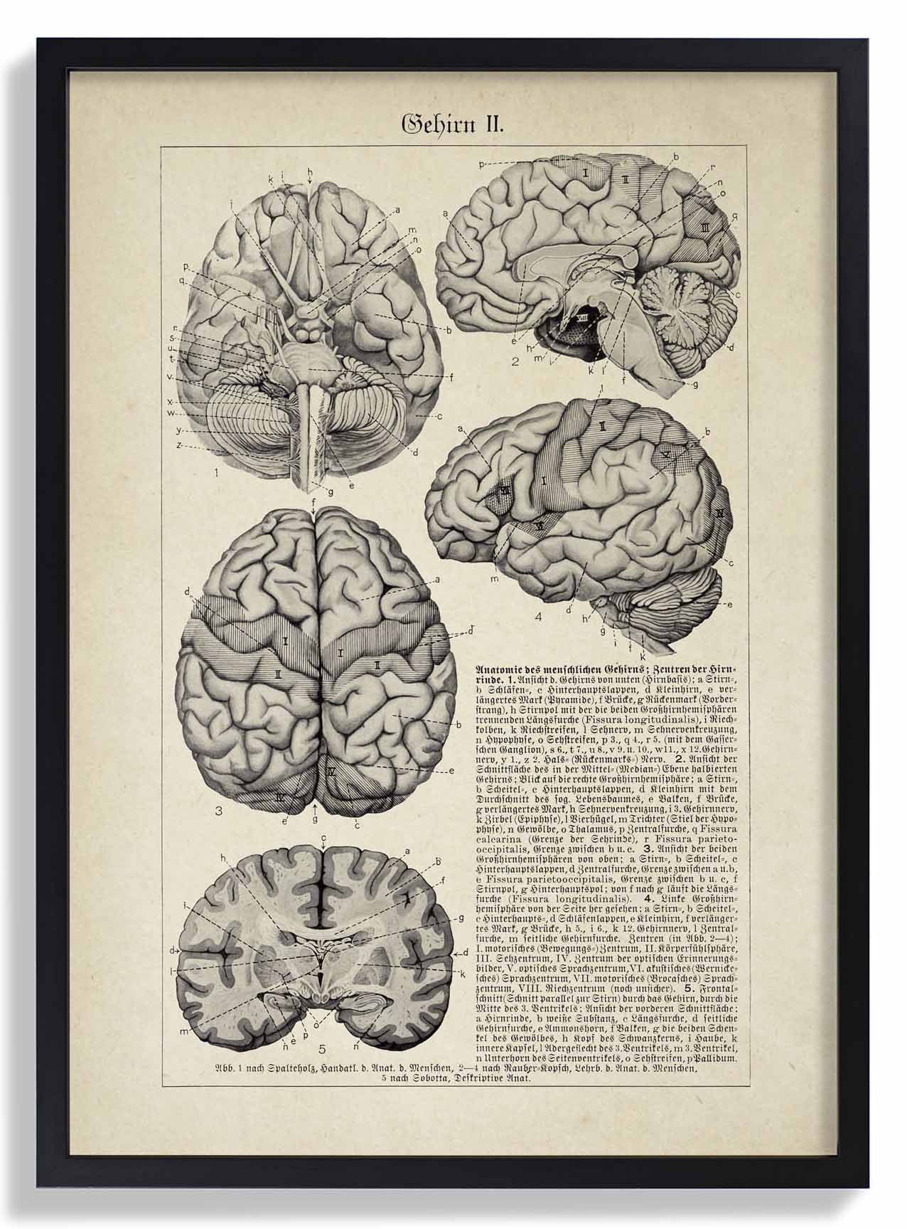 Antique Brain