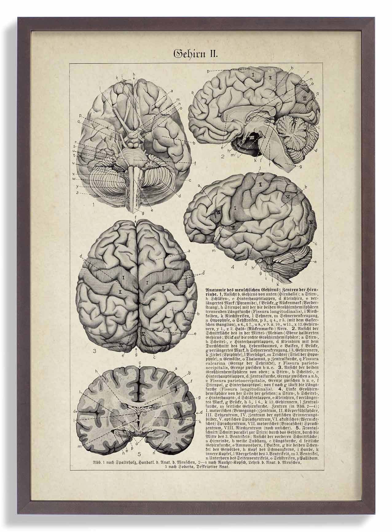 Antique Brain