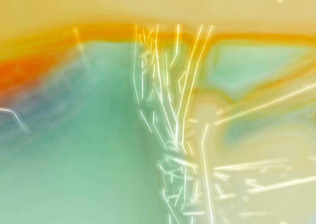 Sonnenverbranntes Kinn Teil.6 von HENRY HU