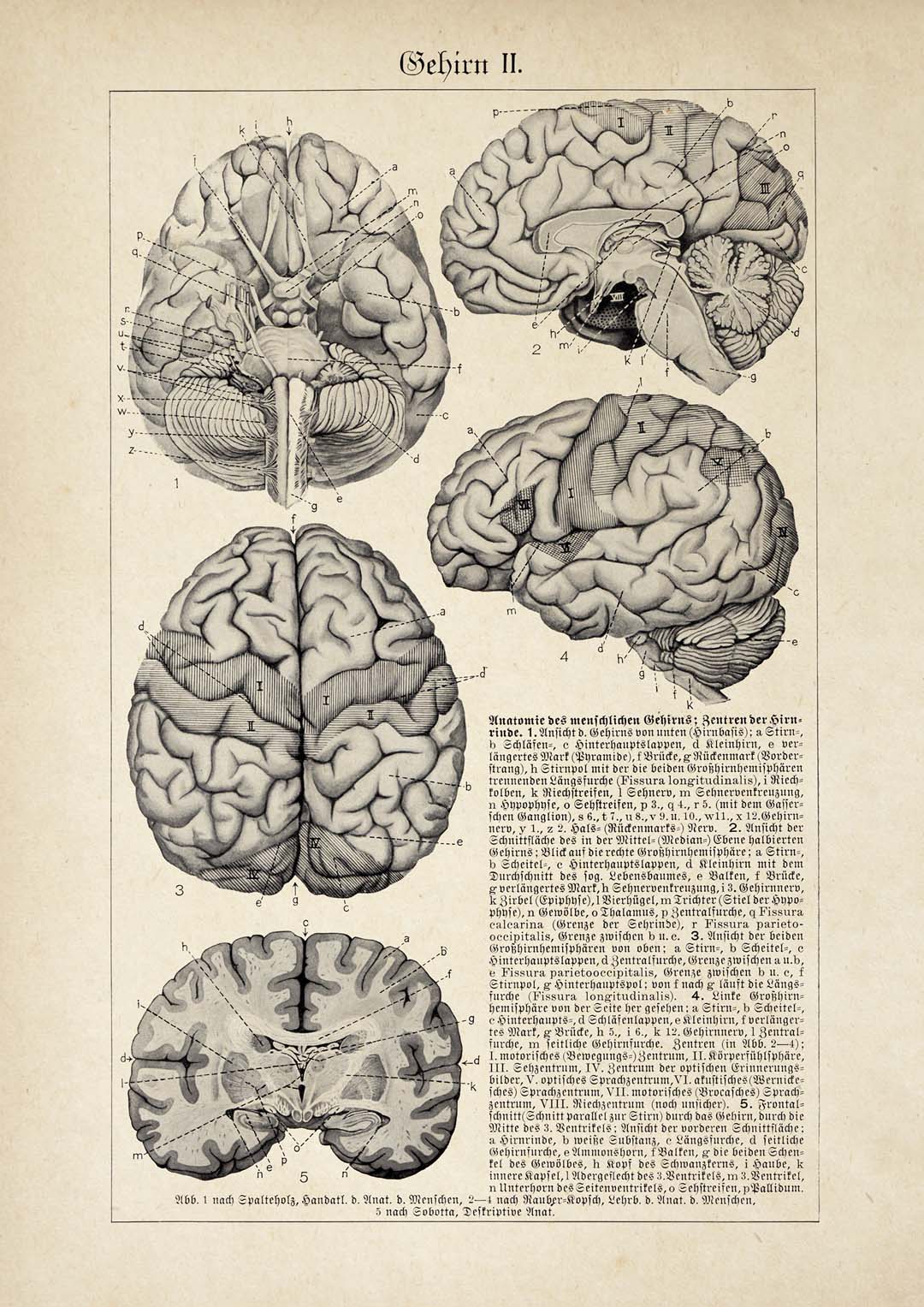 Antique Brain
