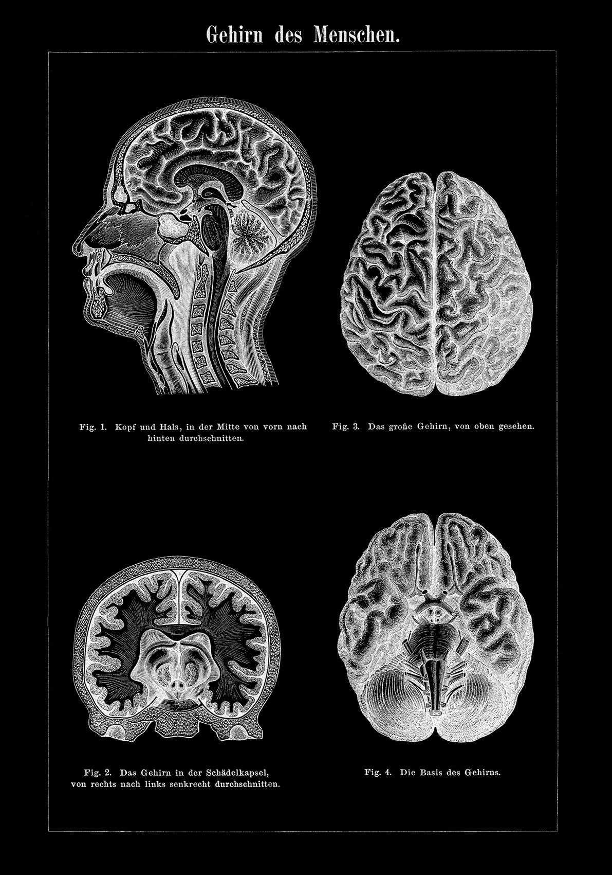 Human Brain Black Anatomy Poster