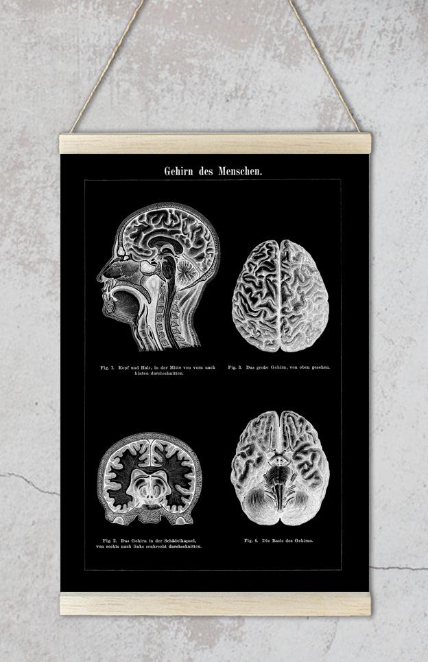 Human Brain Black Anatomy Poster