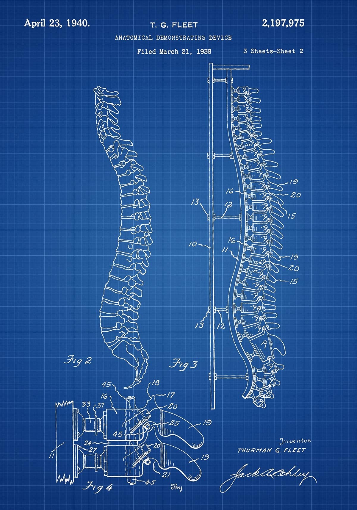 Spine Demonstrating Device Patent Poster