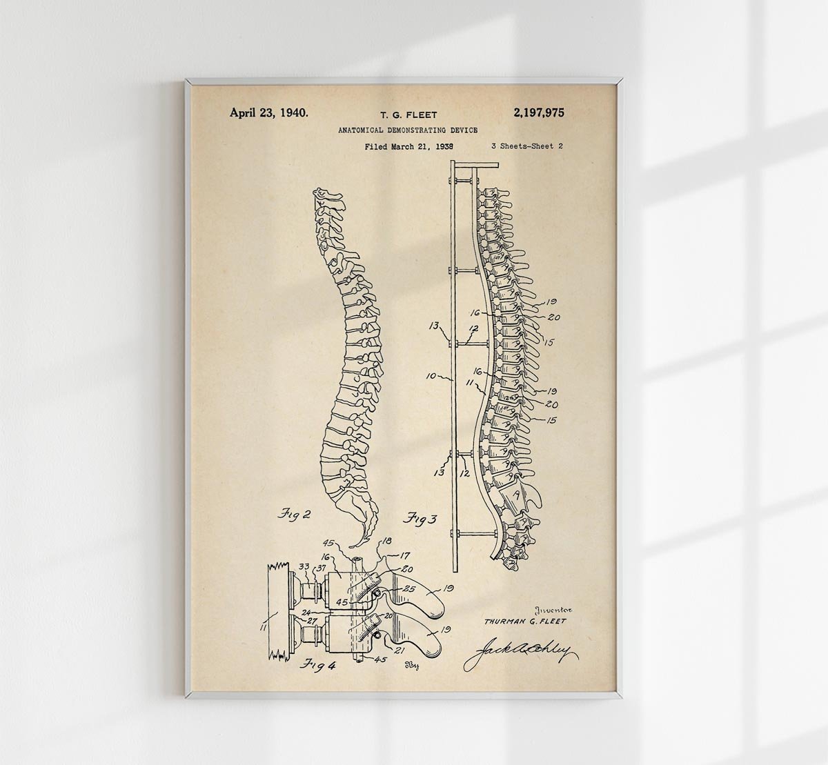 Spine Demonstrating Device Patent Poster