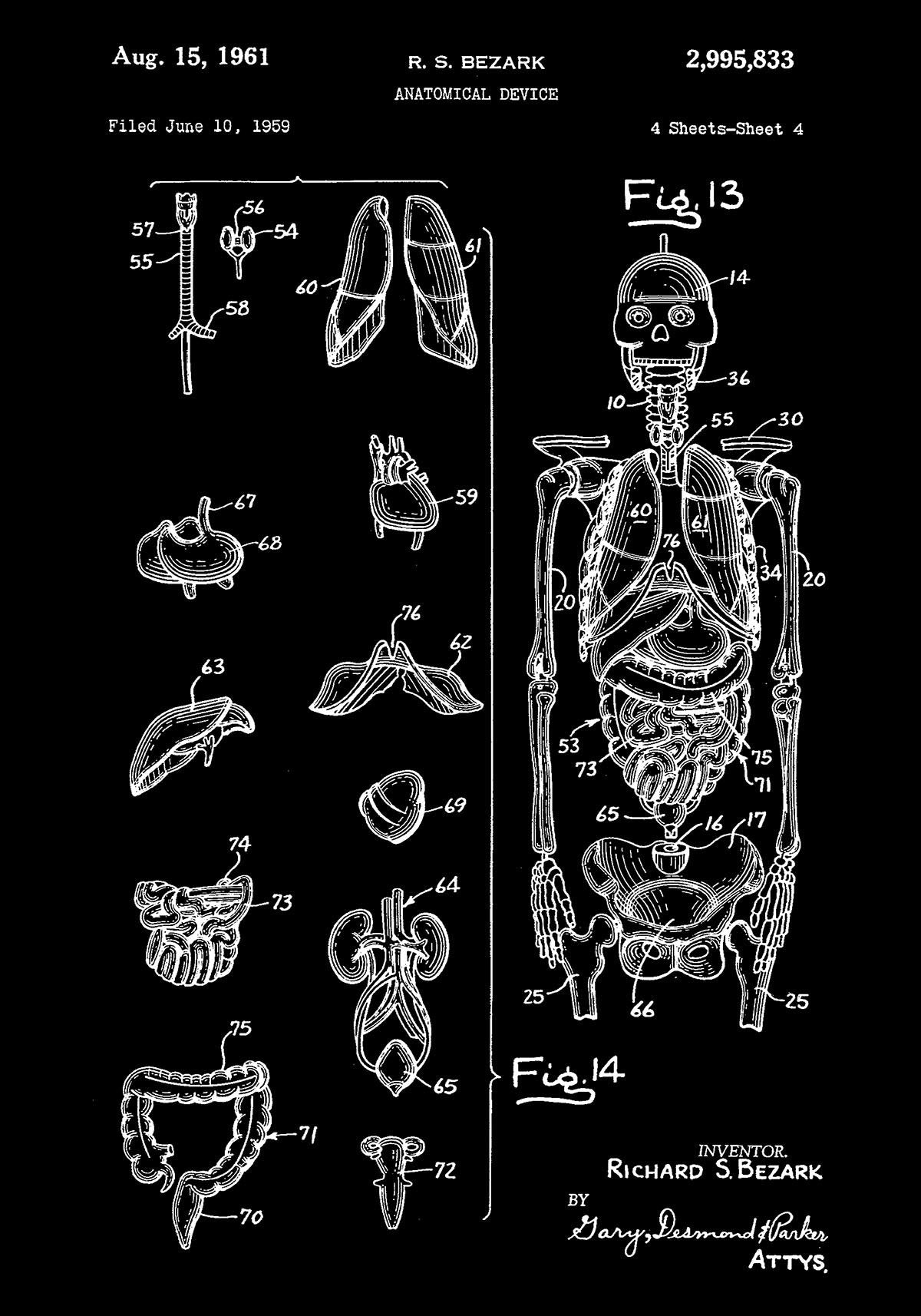 Anatomical Device Patent Poster